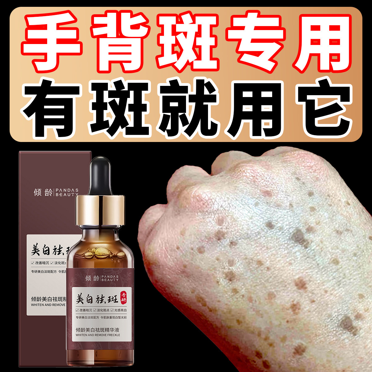 点斑淡斑专用无痕药水正品精华祛遗传雀斑黄褐斑美容金分解黑色素