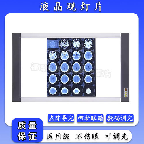 X光阅片灯led观片医用骨科看片