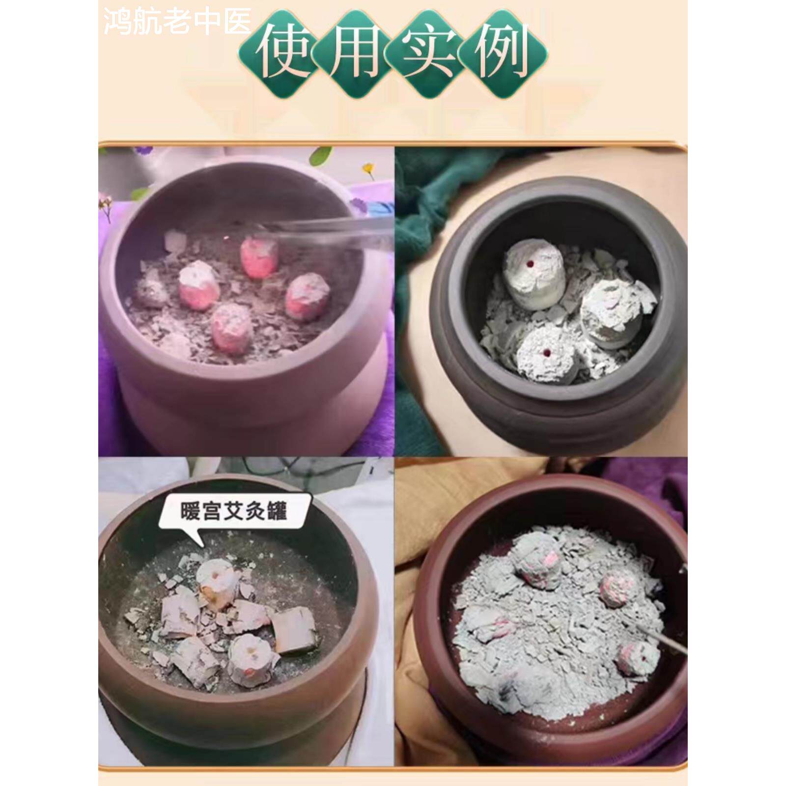鲍姑神灸阳燧灸焫无烟艾柱艾条碳化纯艾砭石肚脐罐灸温阳大罐灸粒