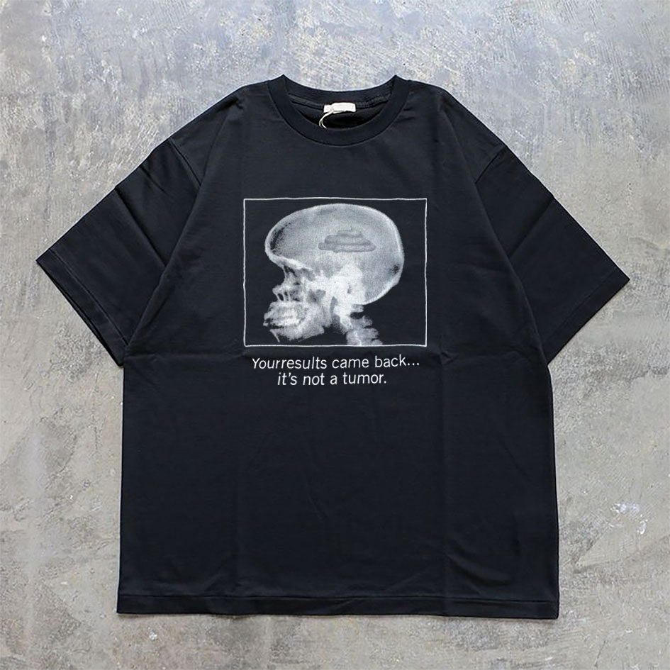 CLFC美式T Shirt Ideas IT IS NOT A TUMOR检查结果小众百搭长短T