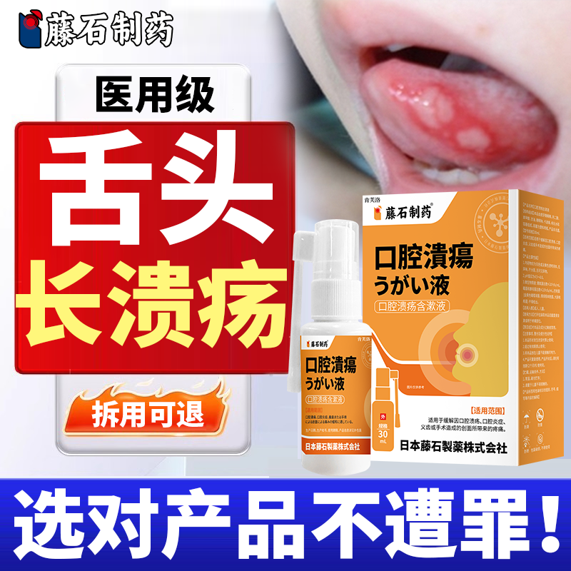舌头溃疡嘴巴口腔溃疡一点灵专用喷雾喷剂非凝胶药房同款儿童YS