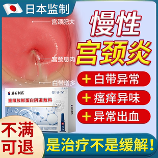 慢性宫颈炎专用炎症炎康栓剂妇科凝胶药房宫颈纳氏囊肿息肉肥大YS