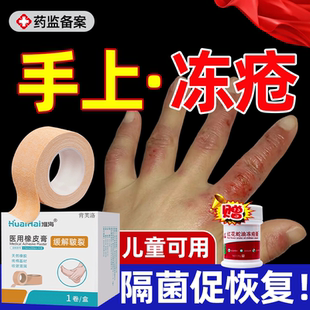 手指冻疮贴专用冻伤贴冻疮膏止痒膏药房冻裂红花蛇油医用级儿童YS