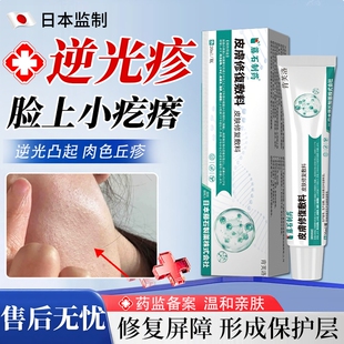 皮肤逆光疹屏障修复脸上起小疙瘩闭口粉刺舒缓膏脸颊两边额头上YY