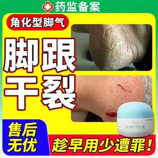 脚后跟角质化角质型干裂真菌感染角化型脚气开裂软膏起硬皮脚跟YS