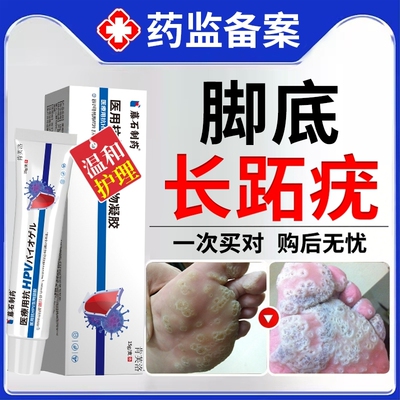 【速发】脚底长跖疣适用