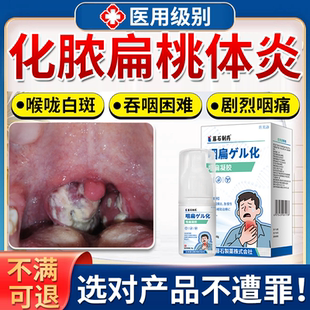 化脓性扁桃体炎扁桃体发炎咽喉喉咙肿痛专用儿童药房同款膏非贴YS