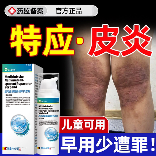 【速发】特应性皮炎瘙痒红斑增厚