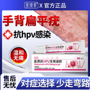 手背扁平疣专用去除软膏一抹灵去扁平尤根的去疣药房膏丝状神器YS