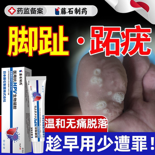 跖疣病毒疣连根拔去足部根脚底除专用去除非碘酊拓趾疣贴药房膏YS
