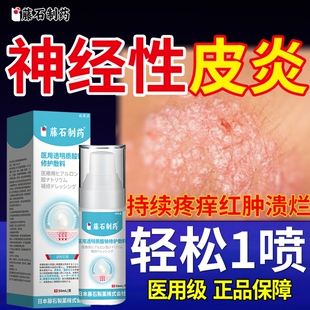 神经性皮炎喷剂瘙痒湿疹止痒膏外用顽固无激素去脂溢性皮炎敷料YM