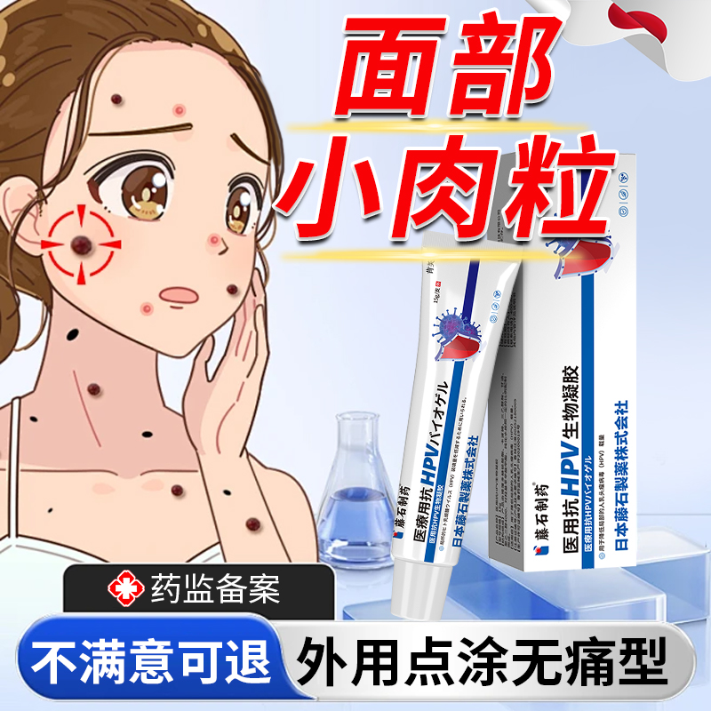 面部扁平疣去疣瘊小肉粒脖子上长小疙瘩去腋下丝状疣软粒除神器YM