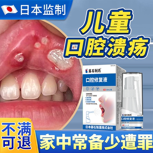 儿童口腔溃疡专用反复药房物喷雾喷雾剂贴非一点灵凝胶上火口疮YS