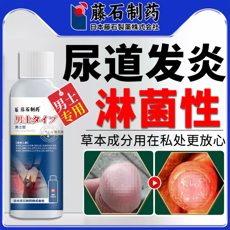 淋病流脓尿道炎男性尿路感染性病梅毒男性病一扫光专用克星男士ro