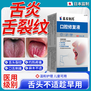 舌炎地图舌专用喷雾舌头裂纹有齿痕舌苔白萎缩性舌康灵药房同款YM