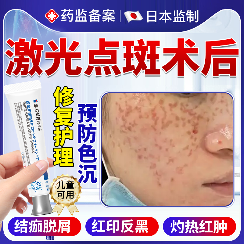 【速发】激光点斑术后护理防色沉
