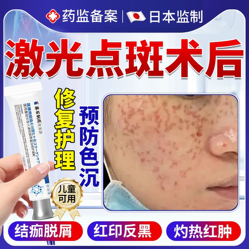 【速发】激光点斑术后护理防色沉