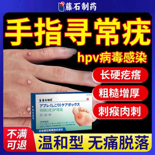 寻常疣专用膏去甲周疣根去除神器药房手指刺猴瘊子手上长硬疙瘩YS