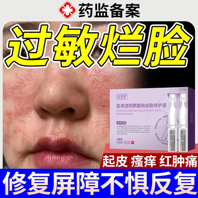 【速发】脸上过敏烂脸红痒起皮用