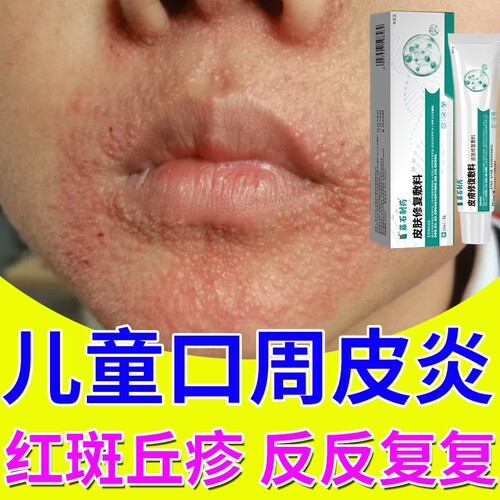 【速发】儿童口周皮炎修复敷料