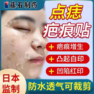 医用疤痕贴点痣后修复膏疤痕红印去黑印色素沉淀增生凸起去YM