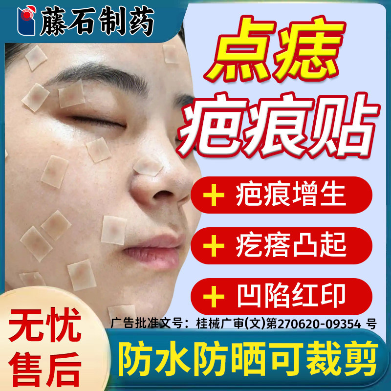 医用疤痕贴点痣后修复膏硅酮凝胶红印去黑印色素沉淀消增生凸起YM
