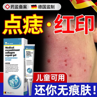 激光点痣后去红印修复膏专用液疤痕去黑印色素沉淀退红淡印面部YS