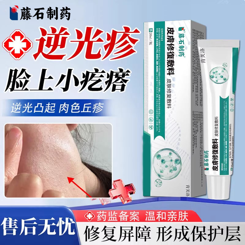 皮肤逆光疹屏障修复脸上起小疙瘩闭口粉刺舒缓膏脸颊两边额头上YY