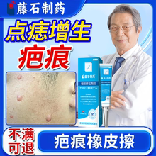 点痣后去增生疤痕修膏疤膏复疤痕增生凸起硬肉去除疙瘩非贴FB