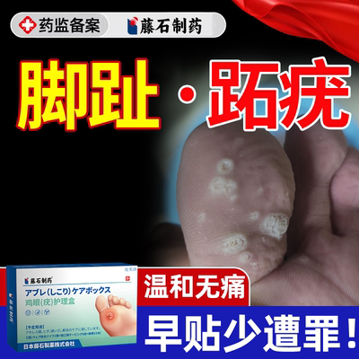 【速发】脚趾长跖疣贴无痛脱落