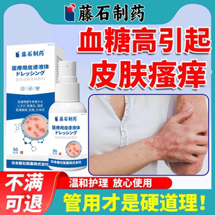皮肤痒专用老年人糖尿病血糖高引起皮肤瘙痒止痒药房同款膏腿痒YS