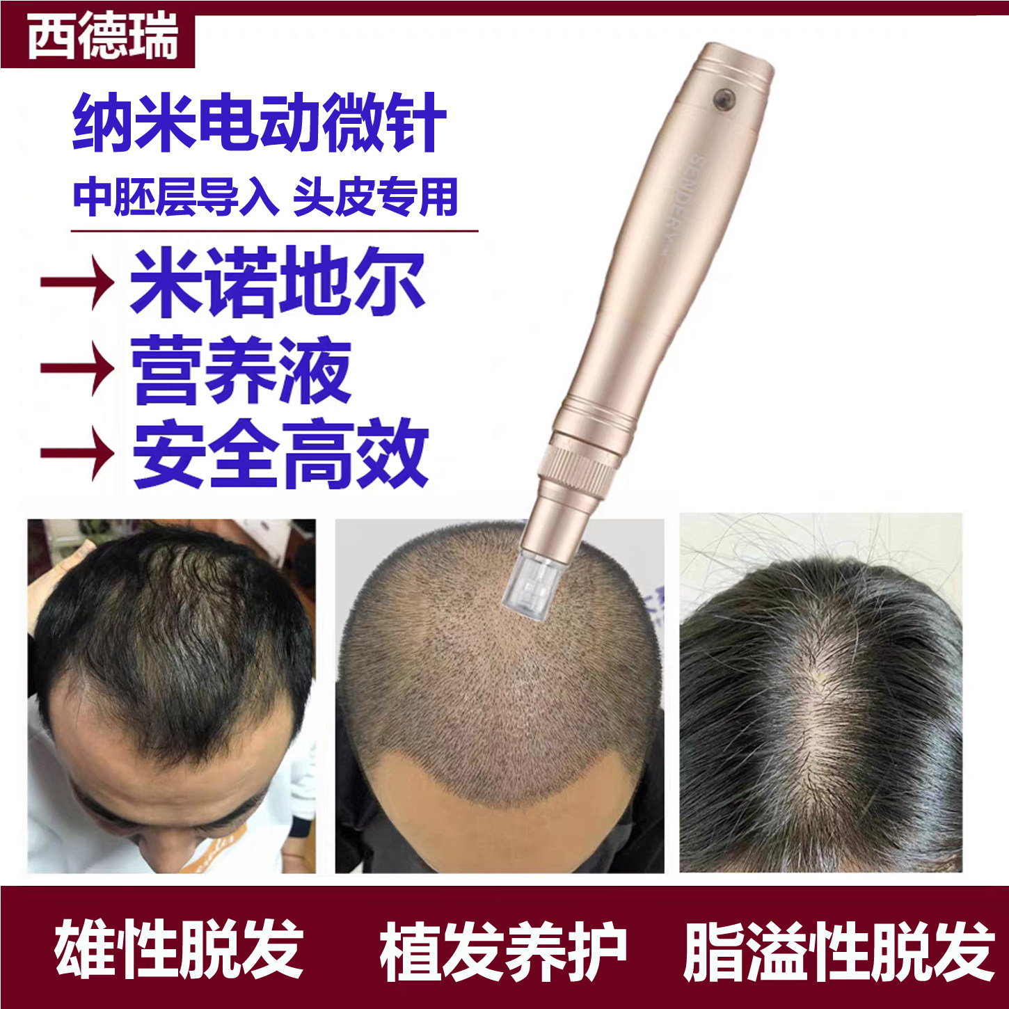 西德瑞电动头皮纳米微晶男女头发生发微针中胚层导入家用促吸收仪