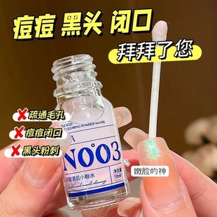 双酸祛痘小粉水改善痘印痘坑去粉刺闭口收缩毛孔水杨酸修复精华液