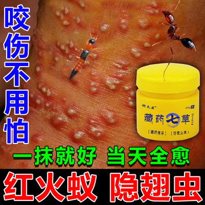 红火蚁药膏户外蚊虫叮咬专用皮炎