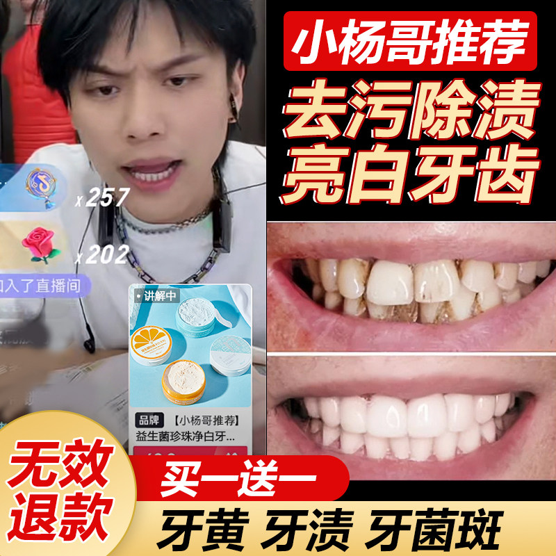 洗牙粉去黄洗白牙石污垢烟渍牙斑牙垢洁牙粉牙齿美白速效黄牙神器