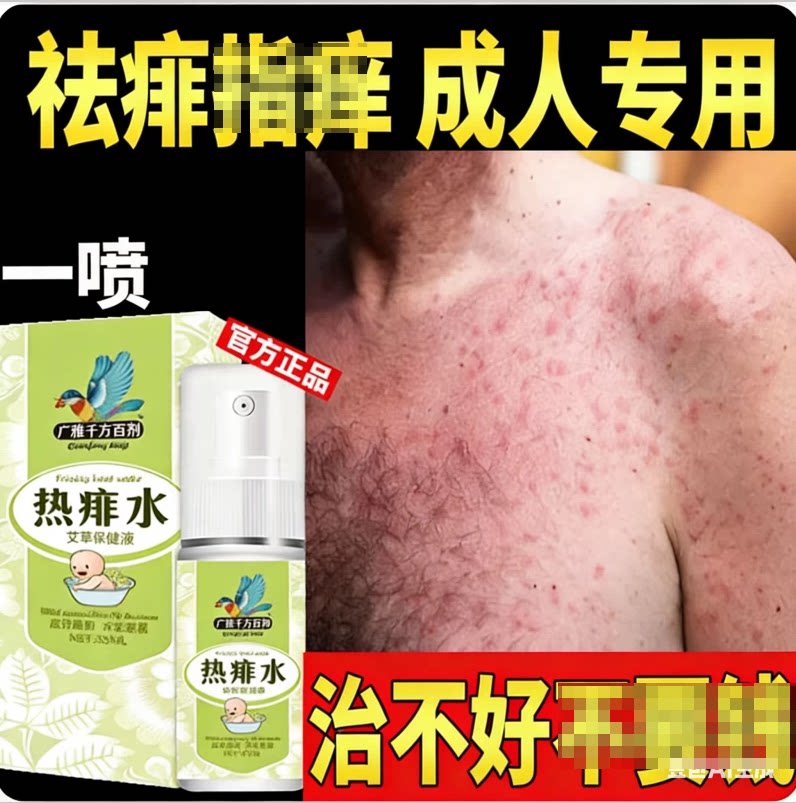 痱子水成人去痱子喷雾液体祛痱膏治除热痱子水大人防菲神器药
