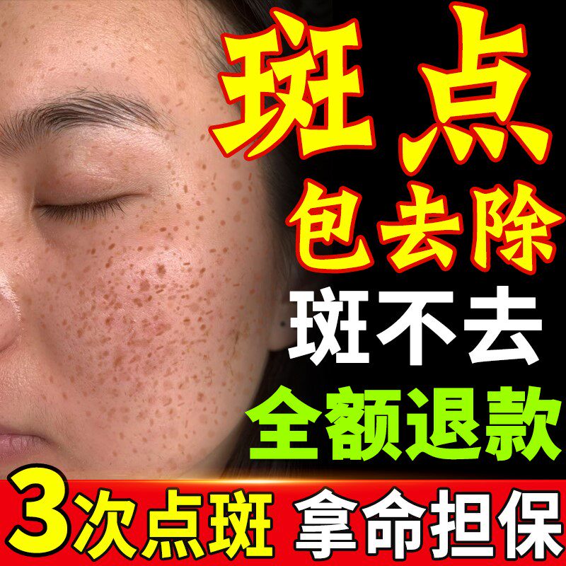 点斑水无痕正品水祛遗传雀斑非专用药水美容院金水液