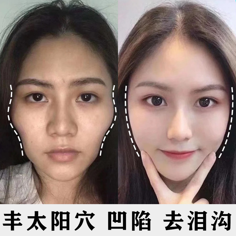 脸颊凹陷图片,面颊凹陷 - 伤感说说吧