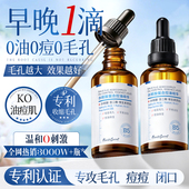 水杨酸精华液收缩毛孔粗大修复祛痘淡化痘印去黑头粉刺果酸b5精华