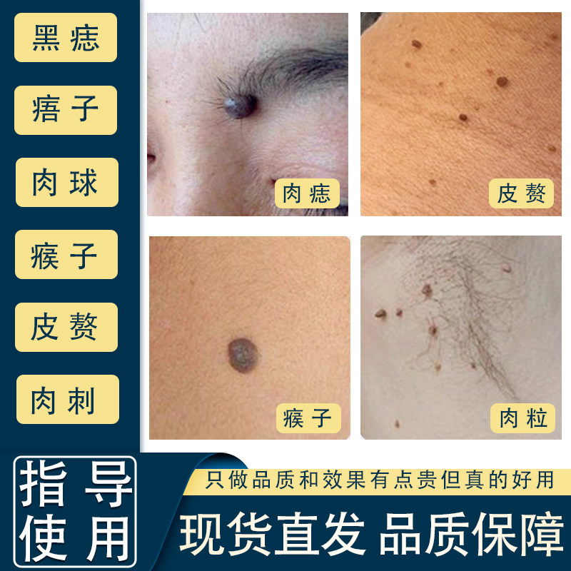 佰草钟医脖子脸上腋下肉粒肉痣头上小疙瘩a+b组合,保健用品,皮肤消毒护理（消）,淘宝优惠券,粉丝福利购,淘宝优惠卷