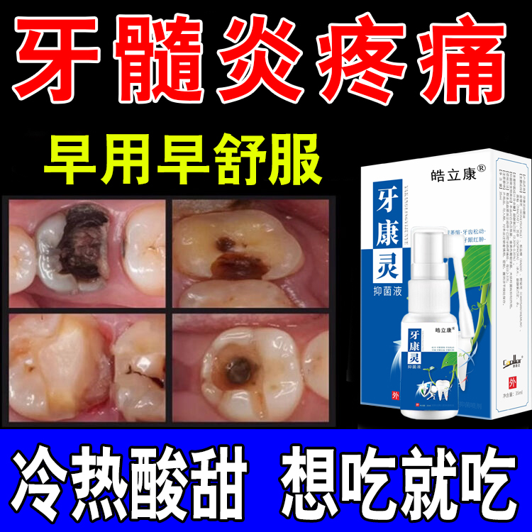 牙髓炎牙神经肿痛止疼牙根发炎牙龈萎缩出血消智齿疼痛牙周炎喷剂