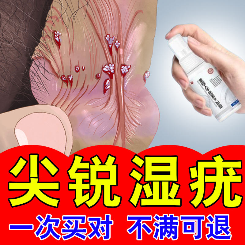 尖锐湿疣喷雾男女性肛门hpv病毒检测自检重组人干扰素a2b去疣喷剂