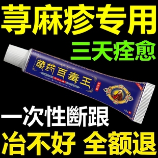 寻荨麻疹过敏止痒