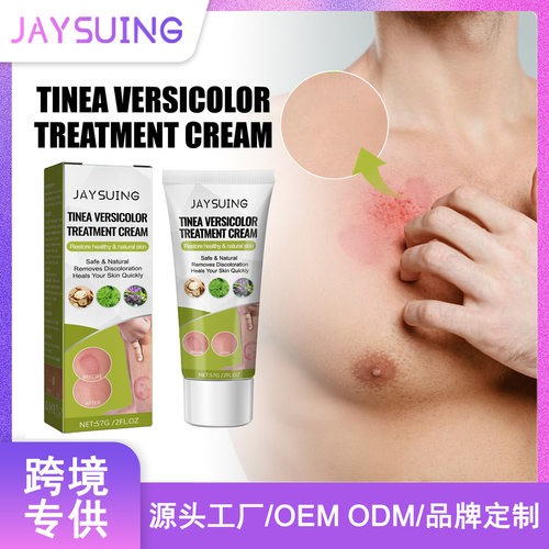 Jaysuing 花斑修护膏 汗斑花斑皮肤外用膏花斑护理修护膏