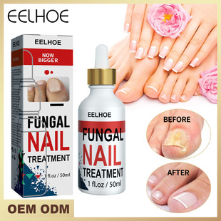 EELHOE 灰指甲修复液手足灰指甲亮甲软甲增厚指甲修护液