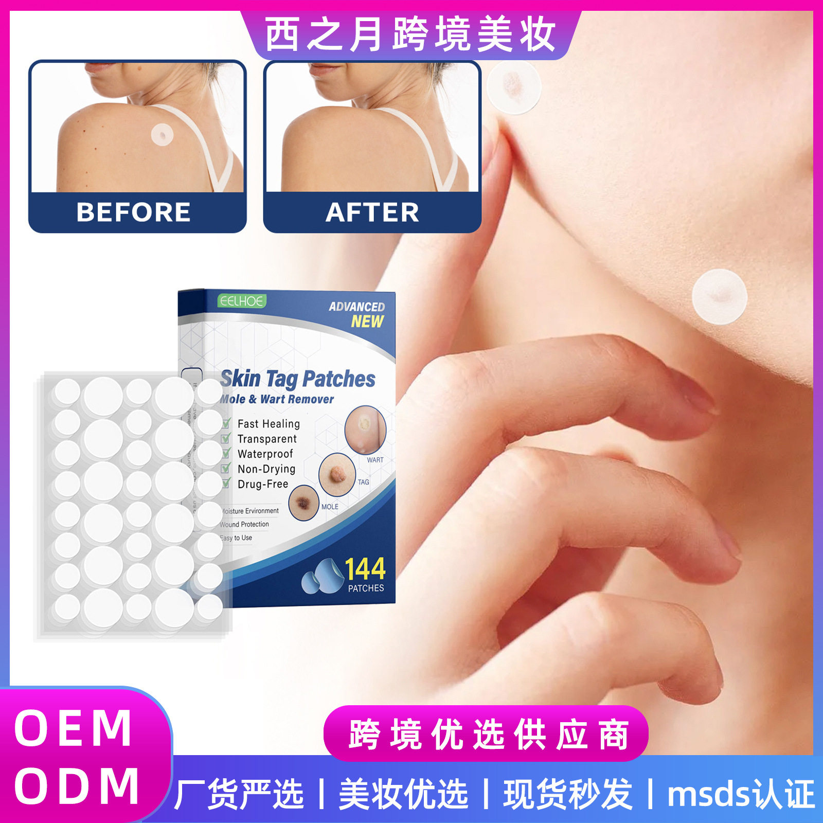EELHOE克贴 皮肤标签淡化剂贴片克肉痣黑痣清洁护理鸡眼贴