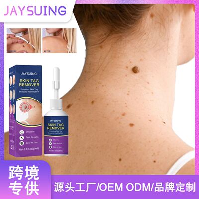 Jaysuing克剂克点痣去脖子小肉粒赘皮扁平尤丝状尤腋下小猴子