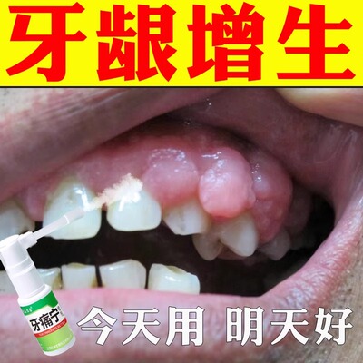 牙龈脓包牙根发炎牙龈肿包痛消炎牙肉增生儿童上火鼓包专用药喷剂