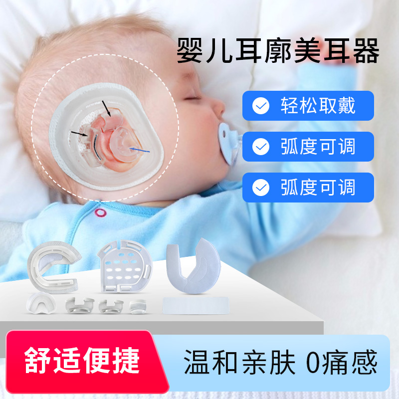 耳朵矫正器婴儿耳廓美耳器贴面