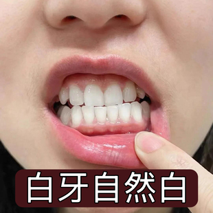 杭州医院【白牙升麻散】牙渍牙垢 牙龈出血 口异味 增白牙齿